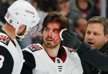 Coyotes rookie Conor Garland gets hit on face, scores, and gets stitches