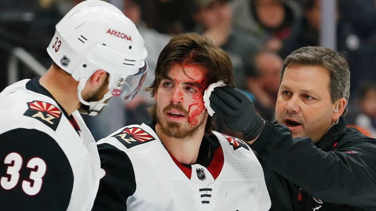 Coyotes rookie Conor Garland gets hit on face, scores, and gets stitches